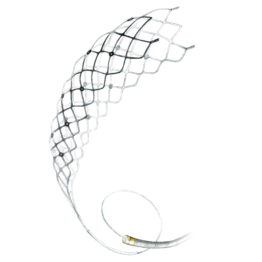 Catchview - Stent Retriever System