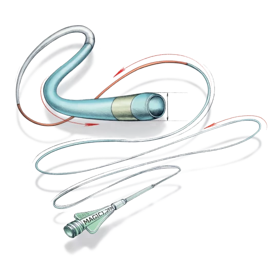 Magic Progressive Suppleness Catheter