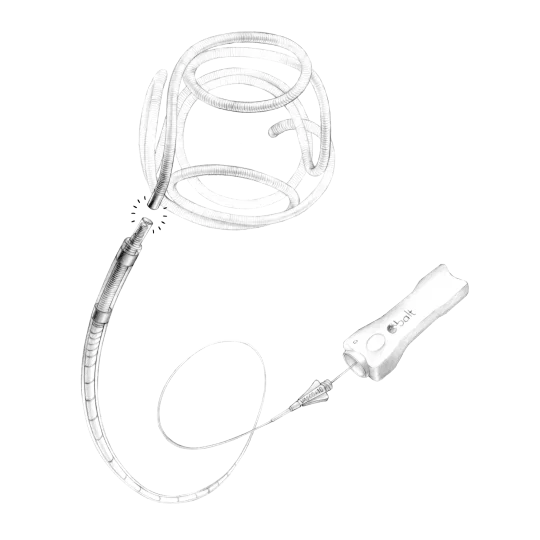 Optima - Embolization Coil System